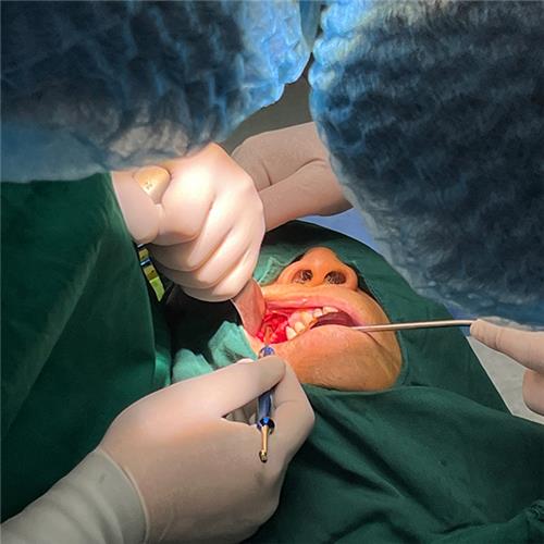 專(zhuān)業(yè)口腔種植手術(shù)